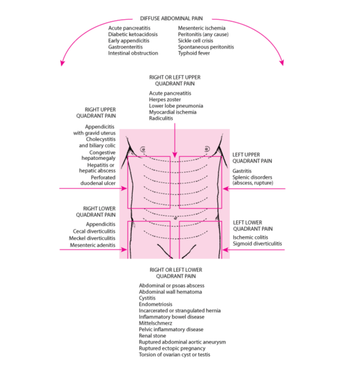 Abdominal regions and associated pain.