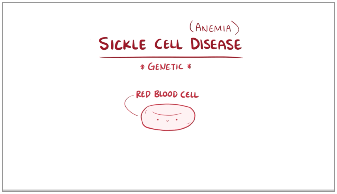 Sickle Cell Disease Video