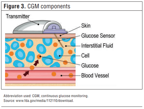 CGM Components